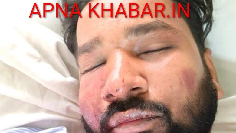 कोरबा बिग ब्रेक :देर रात हुआ कांड ASI के बेटे को कुचला,पत्रकार पर पिस्टल ताना,फायरिंग की,अधमरा होते तक मारा,मरा समझकर लूटे और छोड़ भागे