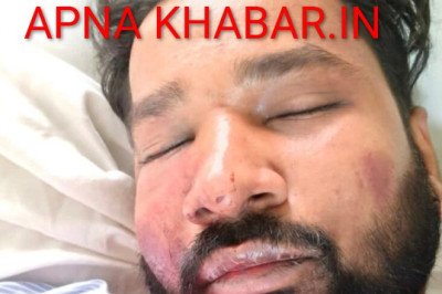 कोरबा  बिग ब्रेक :देर रात हुआ कांड ASI के बेटे को कुचला,पत्रकार पर पिस्टल ताना,फायरिंग की,अधमरा होते तक मारा,मरा समझकर लूटे और छोड़ भागे